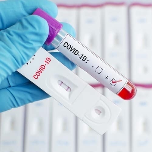 27 са заразените с COVID-19 в първия ден на годината, няма починали през последното денонощие