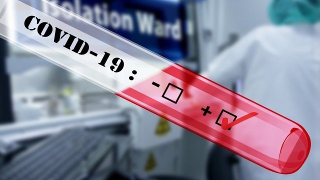23 нови случая на COVID-19 областта, сред тях един педагог