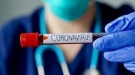 Заболяемостта от коронавирус в областта отново доближава 400 на 100 хил. души