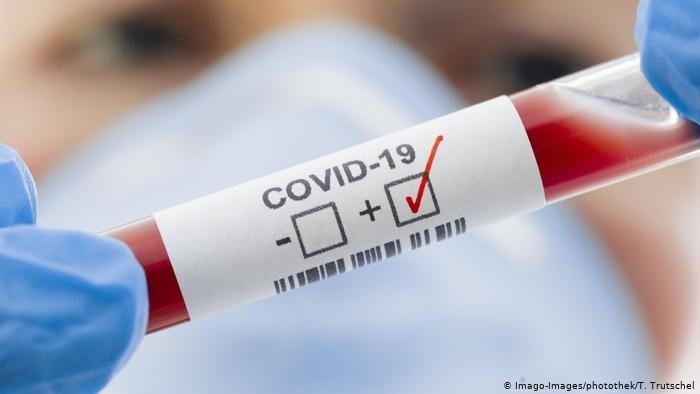 56 заразени и двама починали с COVID – 19 в областта през последното денонощие